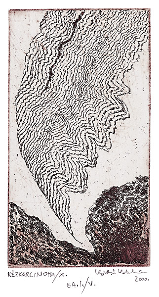 R&eacute;zkarcinoma /10.